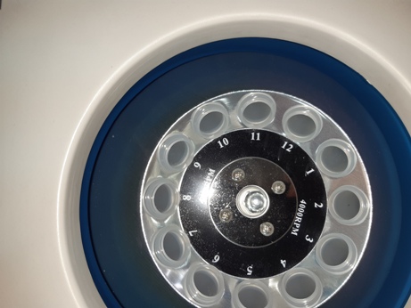 tsentrifuga plazmolifting 6-1