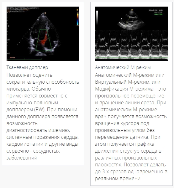 Affiniti 30 tehnology
