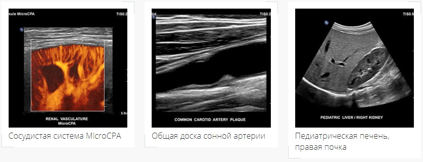 images EPIQ 5 images EPIQ 5